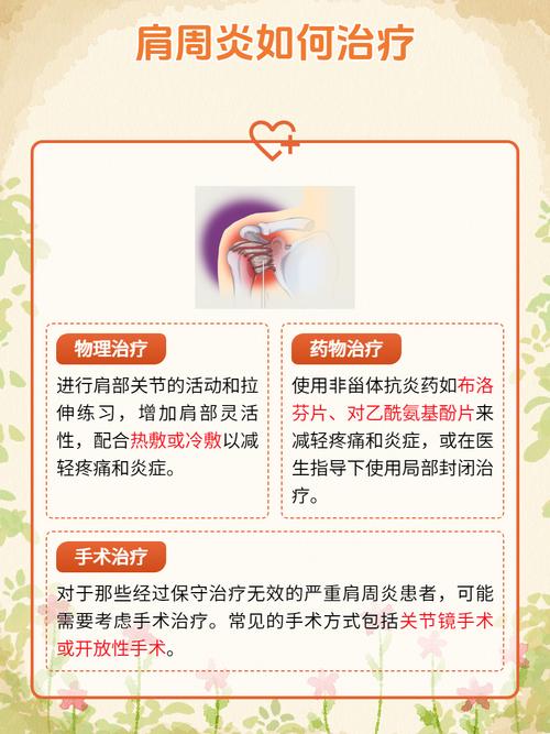科普|肩周炎的自限性,意味着不治也能自己好? 第1张 科普|肩周炎的自限性,意味着不治也能自己好? 第1张